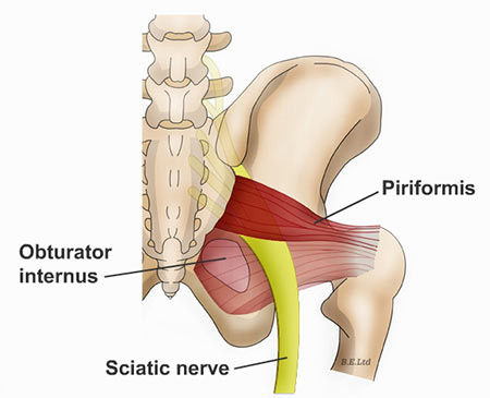 Piriformis Syndrome Treatment Doctor in NYC - Sports Injury Clinic