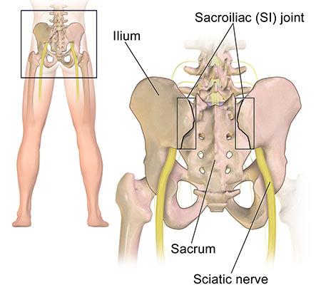 That Hip Pain Could Actually Be a Sciatica Problem - Physical Therapists NYC
