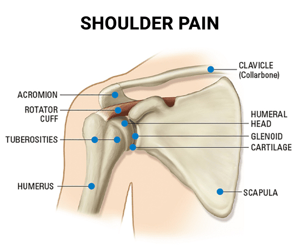 Shoulder Pain Treatment NYC  Shoulder Pain Doctors Specialists NY